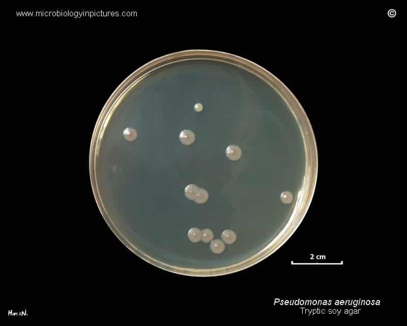 Pseudomonas Lab Testing